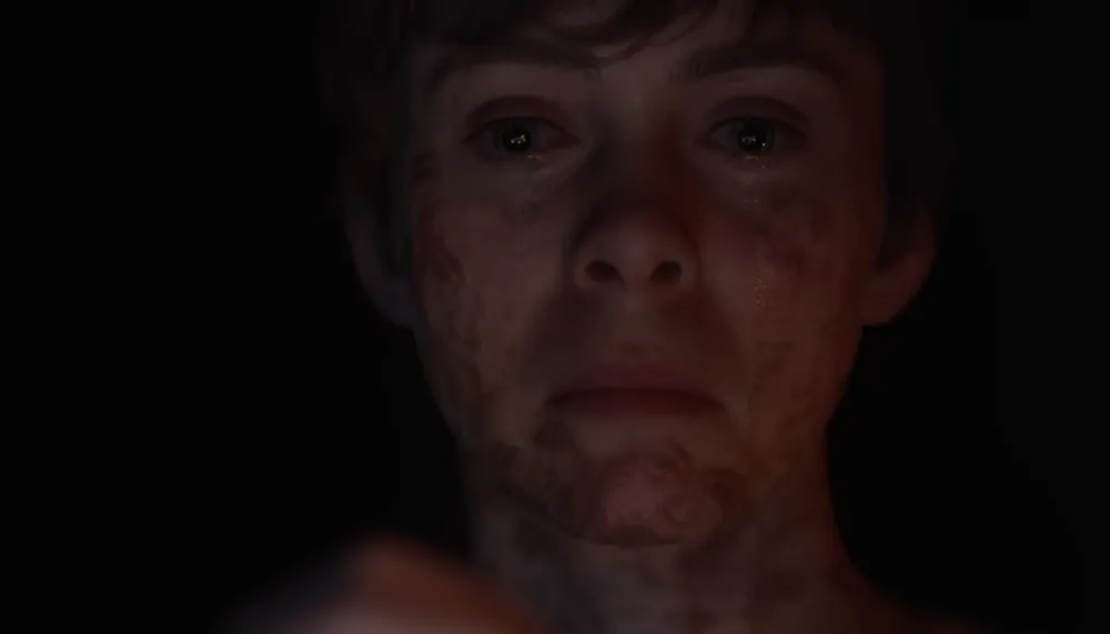 Extreme close-up of a pale young person's face emerging from darkness, skin blotched and eyes glistening, from an OD teaser.